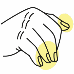 Psoriasis or nail fungus