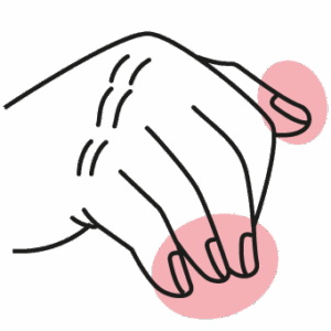 Damaged nails